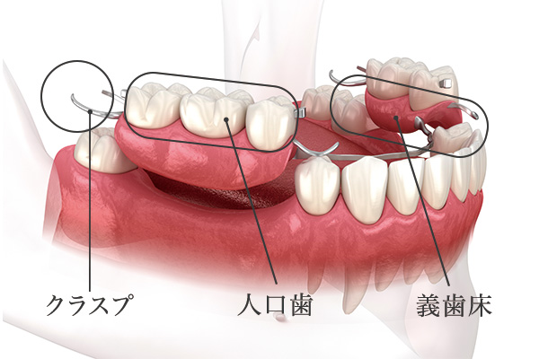 入れ歯のパーツ