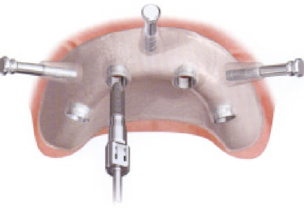 ノーベルガイド