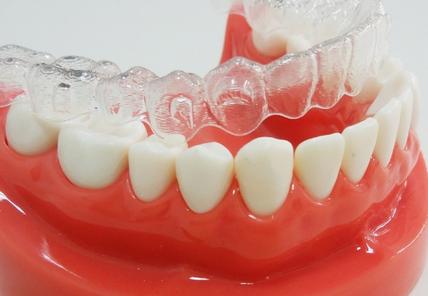 インビザライン矯正