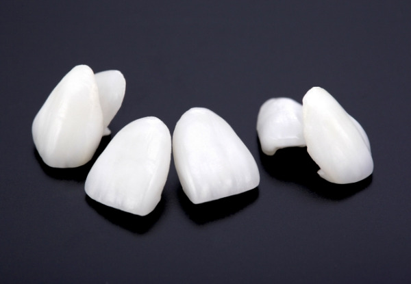 ラミネートベニア