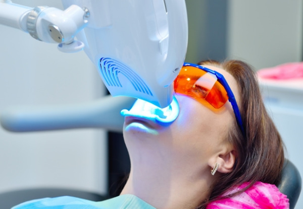 オフィスホワイトニング