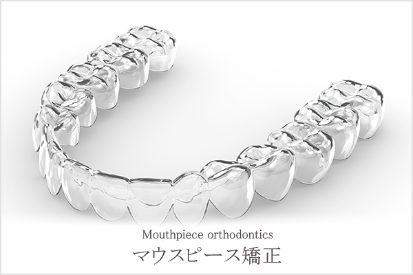 マウスピース矯正