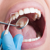 虫歯・歯周病治療アイコン