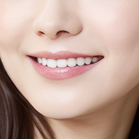 審美歯科アイコン