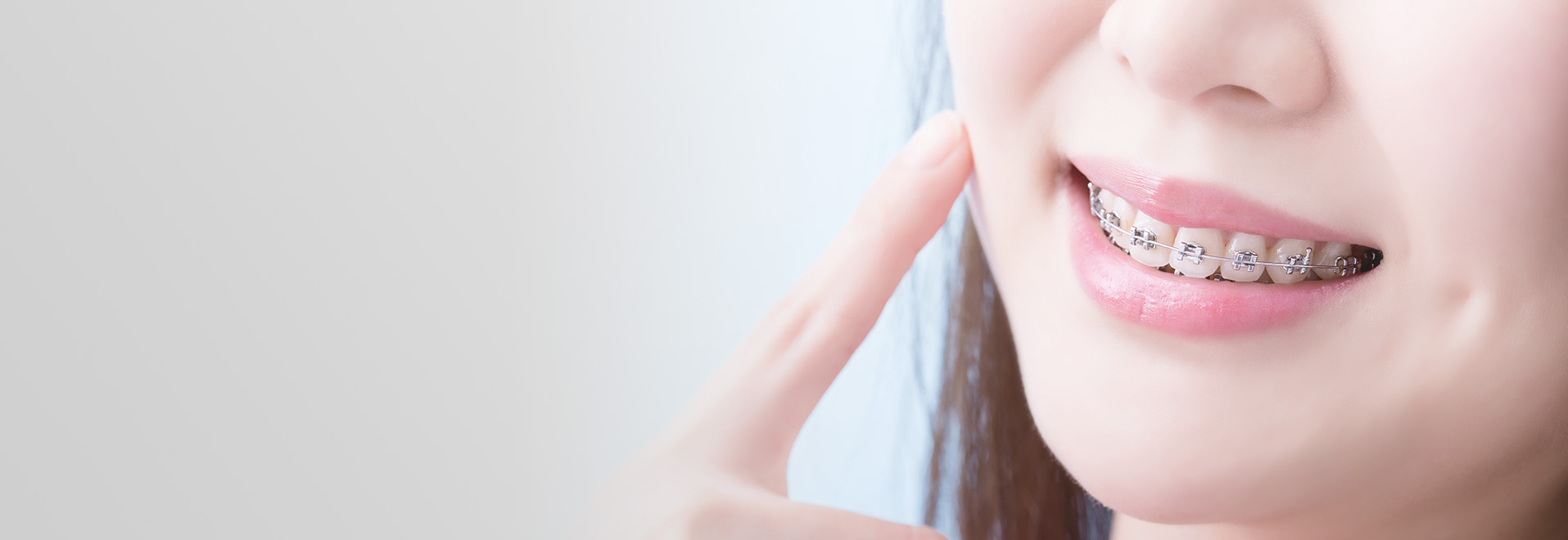 ワイヤー矯正 イメージ