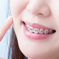 ワイヤー矯正※インデックス用アイコン